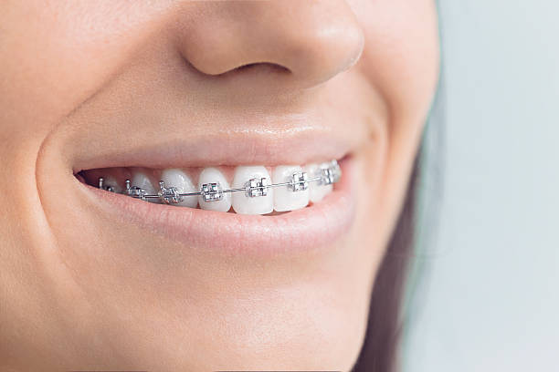 Best Wisdom Tooth Removal  in Hanover, IN